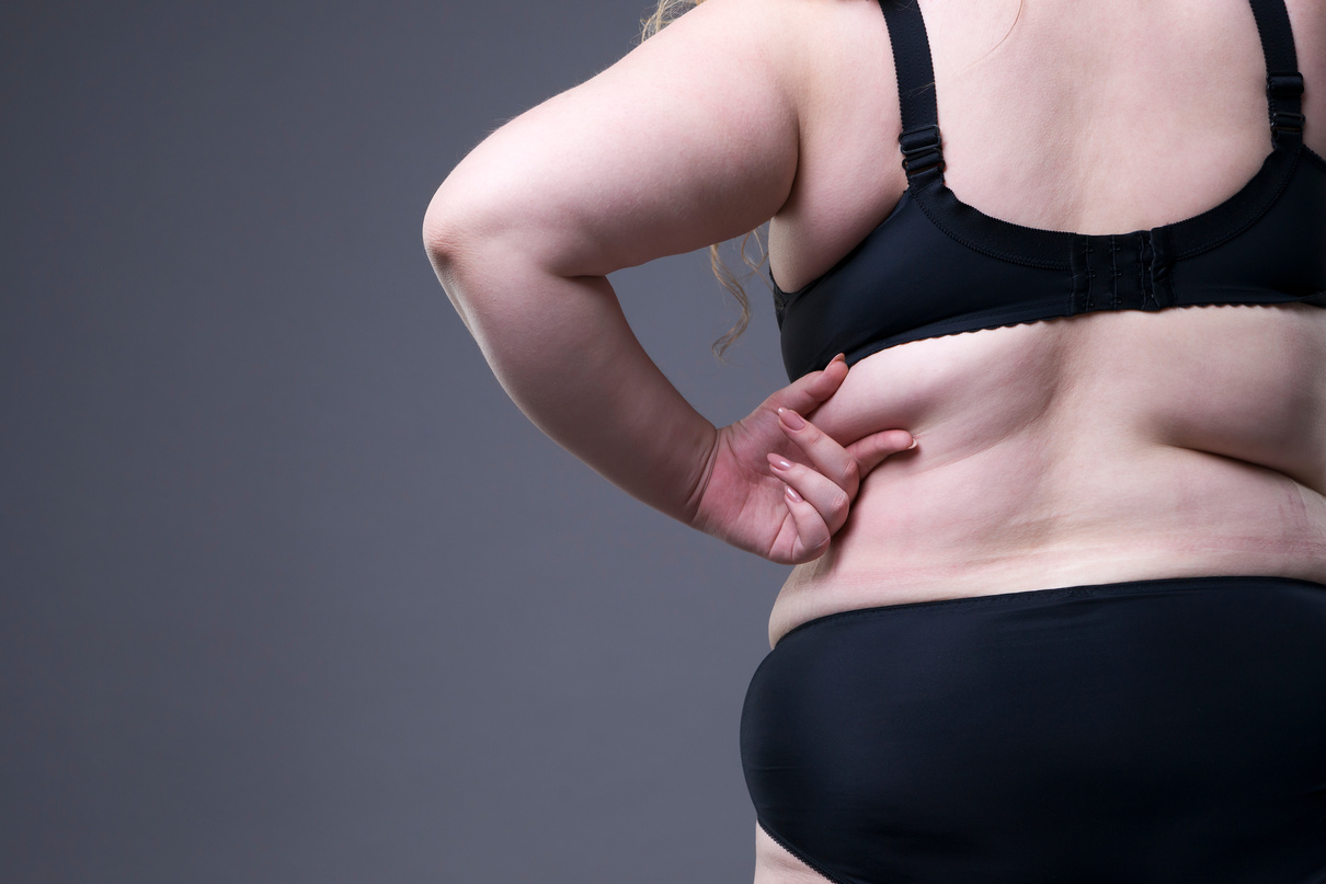 Plus Sized Women Pinching Her Back Rolls