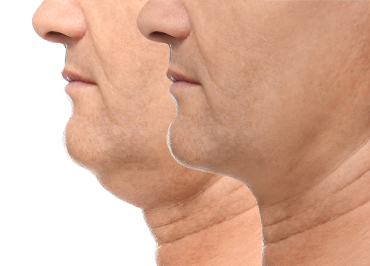 Mature Man with Double Chin on White Background, Closeup