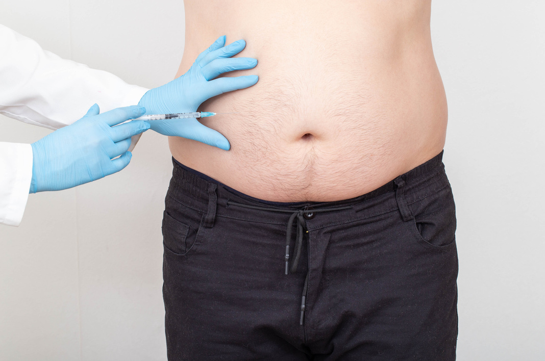 Doctor Injecting a Syringe on Plus Size Person's Abdomen